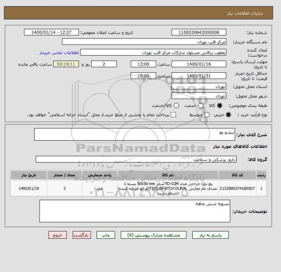 استعلام تیشو پچ